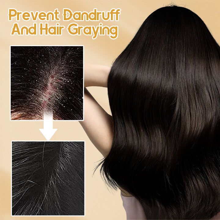 Dobshow™ Anti-Hair Loss Ginger Shampoo Soap