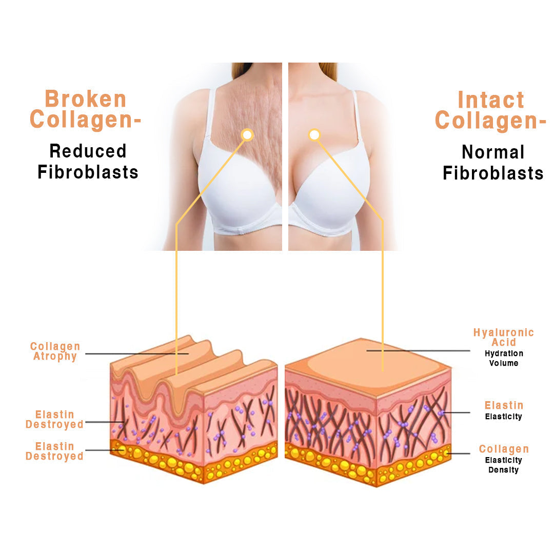 Nurbini™ RevitaChest Smoothing Treatment Patch